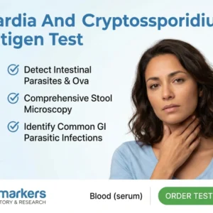 giardia-cryptosporidium-antigen-test