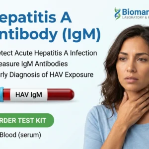 hepatitis-a-antibody-igm-test