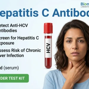 hepatitis-c-antibody-test