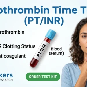 prothrombin-time-pt-inr-test