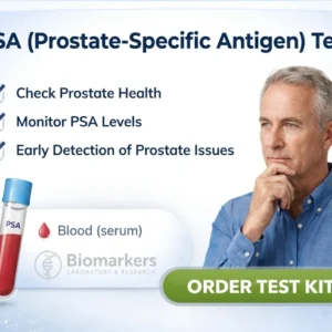 psa-prostate-specific-antigen-test