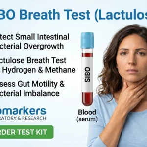 sibo-breath-test-lactulose